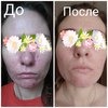 Гель-крем для лица La Roche Posay Effaclar DUO[+] фото