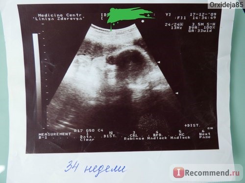 Фото УЗИ при беременности фото