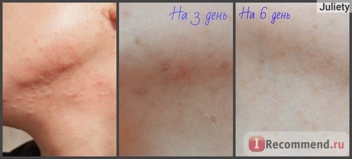 Эфирное масло AROMA BIO Лаванда 100% натуральное фото