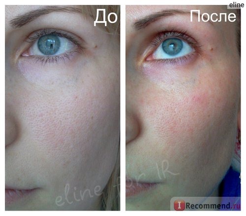 Сыворотка для лица Lancome Visionnaire фото