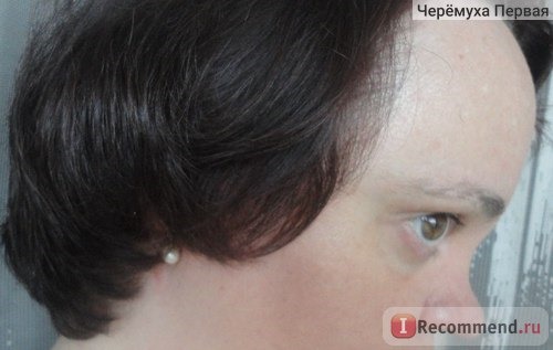 Clear VITA ABE Защита от выпадения волос