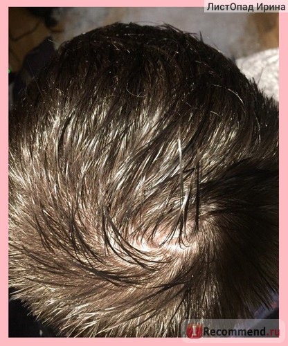 Шампунь Weleda Растительный с просом для нормальных волос фото