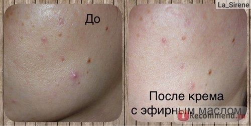 Эфирное масло DR.TAFFI Ниаули (Niaouly essential oil) фото