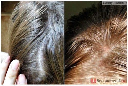 Шампунь Белита-Витэкс Стимулирующий для роста и укрепления волос фото