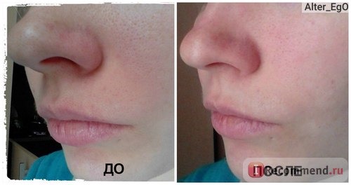 Маска-пленка для кожи лица Aliexpress 10x Herbal Deep Clean Nose Pore Cleansing Strips Blackheads hv3n фото