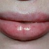 Фото после нанесения бальзама (он прозрачный, имеет тающую структуру и губы обретают блеск, со временем впитывается и губы увлажненные)