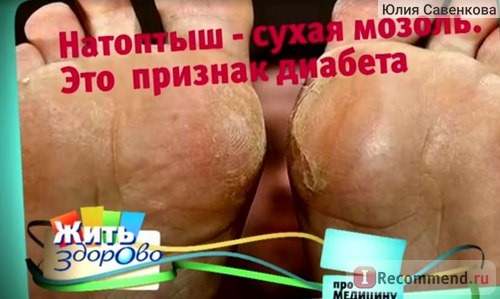 Жить здорово фото