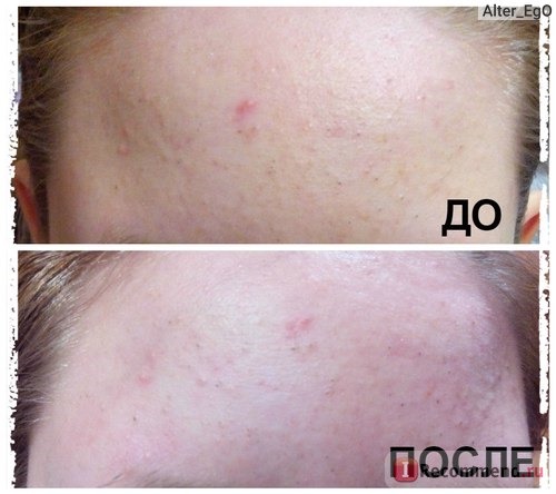 Маска-пленка для кожи лица Aliexpress 10x Herbal Deep Clean Nose Pore Cleansing Strips Blackheads hv3n фото