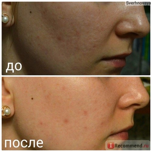 Тканевая маска для лица La miso с экстрактом лечебных трав Herb Essence Mask Sheet фото