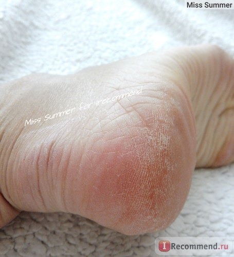 Крем для ног EVO с мочевиной 10% фото