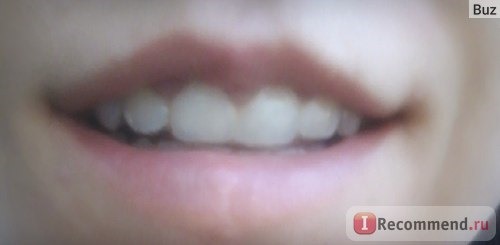 зубы сразу после снятия (до применения масла)