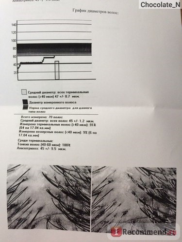 Компьютерная диагностика волос (Трихоскопия) фото