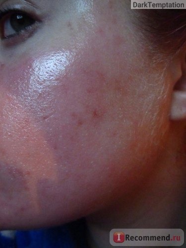Облезает кожа после загара – почему и что делать