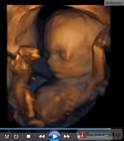 4D УЗИ во время беременности фото