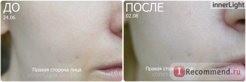 Эликсир Белита-Витэкс Омоложение кожи для лица ИНТЕНСИВНЫЙ КУРС LuxCare фото
