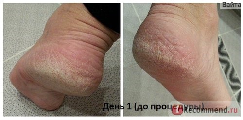 Крем для ног Floresan Кератолитический, Organic foot care фото