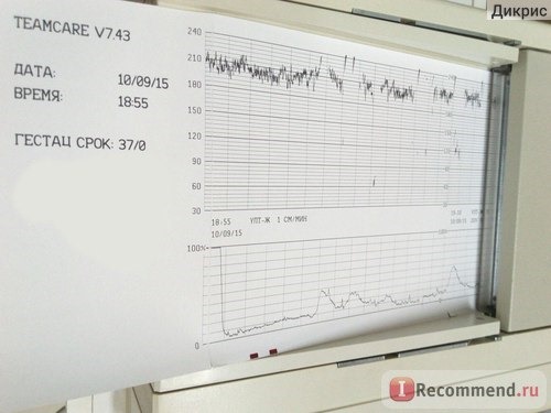 сердцебиение плода - 200 - 230 ударов в минуту