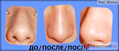 Скраб для лица Clean&Clear ОТШЕЛУШИВАЮЩИЙ ГЛУБОКОГО ДЕЙСТВИЯ фото