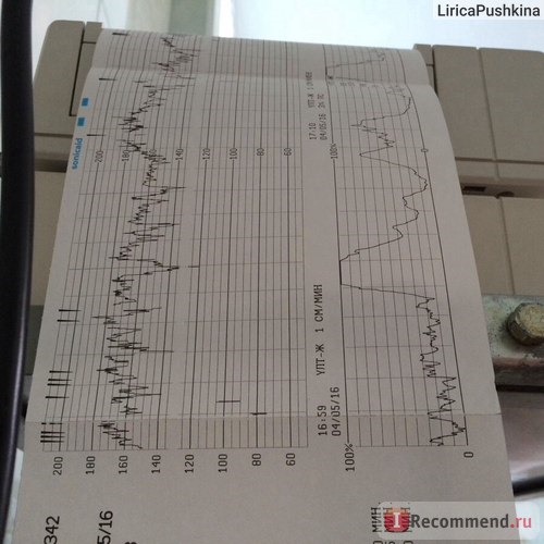 Ктг: схватки ещё были малоощутимые