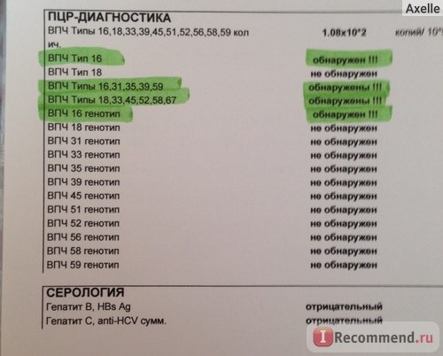 Результаты ПЦР-диагностики на ВПЧ онкогенного типа